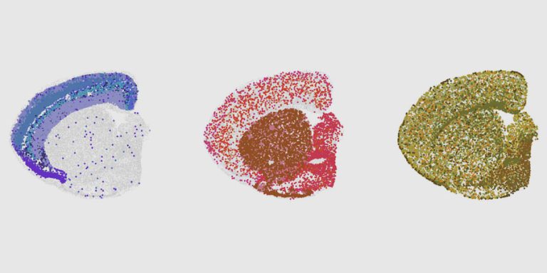 What changes happen in the aging brain?