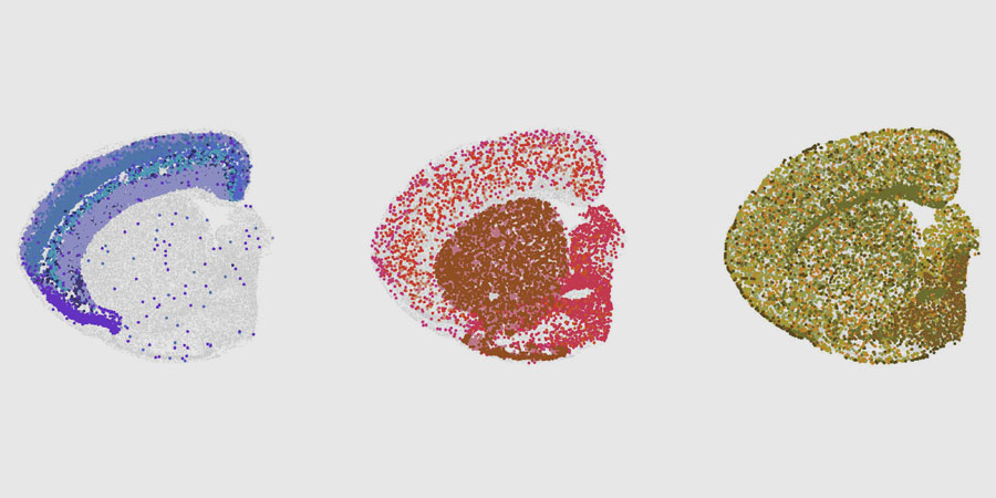What changes happen in the aging brain?