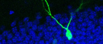 small-molecule-keeps-new-adult-neurons-straying-may-tied-schizophrenia