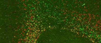 new-kinds-brain-cells-revealed