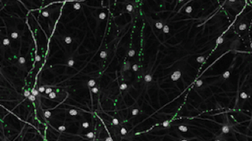 Aged-mitochondria-green-in-old-neurons-gray-appear-mostly-as-small-punctate-dots-rather-than-a-large-interconnected-network