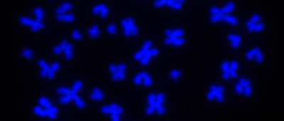 computational-tool-lets-researchers-identify-cells-based-on-their-chromosome-shape