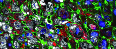 cellular-regeneration-therapy-restores-damaged-liver-tissue-faster-than-ever