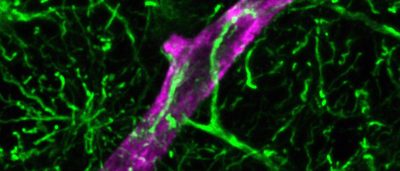 more-than-just-neurons-a-new-model-for-studying-human-brain-inflammation