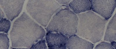 estrogen-related-receptors-could-be-key-to-treating-metabolic-and-muscular-disorders