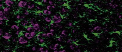 astrocyte-protein-linked-to-healthy-brain-connections-could-inspire-new-treatments-for-alzheimers