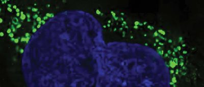 astrocyte-protein-linked-to-healthy-brain-connections-could-inspire-new-treatments-for-alzheimers-3-2-2-2-2