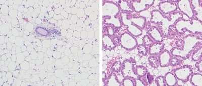 astrocyte-protein-linked-to-healthy-brain-connections-could-inspire-new-treatments-for-alzheimers-3-2-2