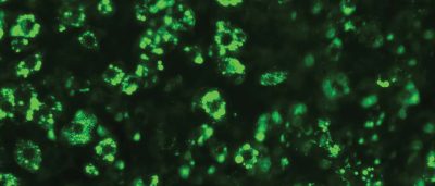 astrocyte-protein-linked-to-healthy-brain-connections-could-inspire-new-treatments-for-alzheimers-3-2-2-2-2-2-2