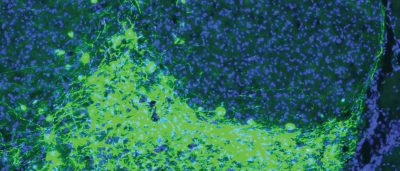 astrocyte-protein-linked-to-healthy-brain-connections-could-inspire-new-treatments-for-alzheimers-2